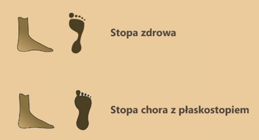 Na problemy z kolanami i stopami