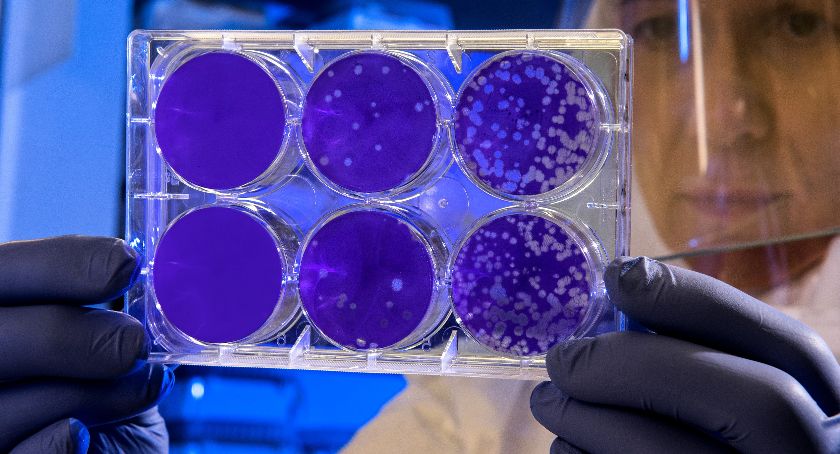 U mieszkańca Bielska-Białej nastąpiła reaktywacja koronawirusa. Stan epidemiologiczny na 19.06 z podziałem na gminy