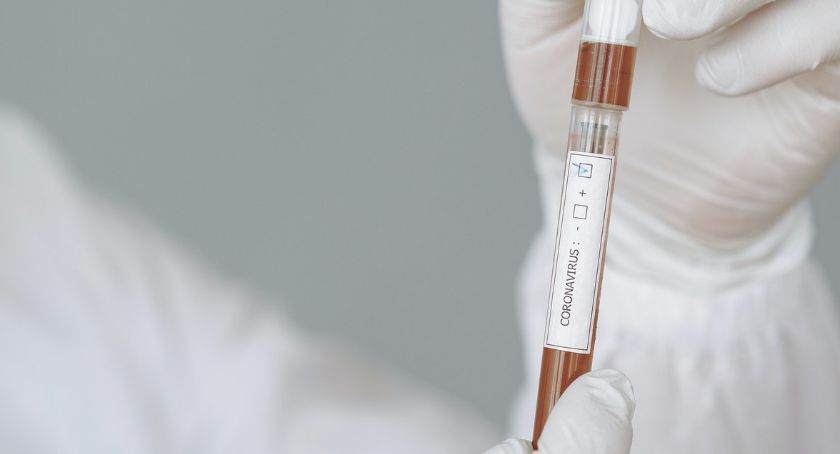 Stan epidemiologiczny na 29.06 z podziałem na gminy