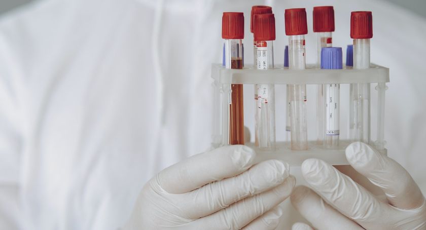Stan epidemiologiczny na 21 listopada | Ponad 700 osób w regionie wyzdrowiało