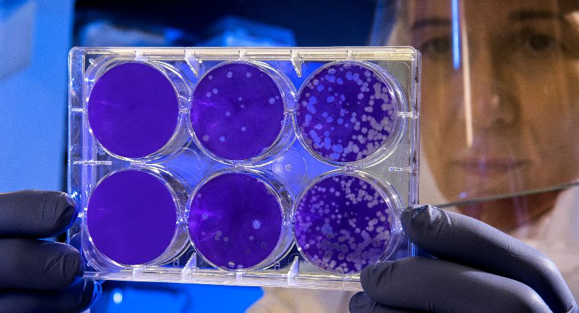 Ministerstwo zdrowia opublikowało dane epidemiologiczne za wczoraj | 76 zakażeń w regionie