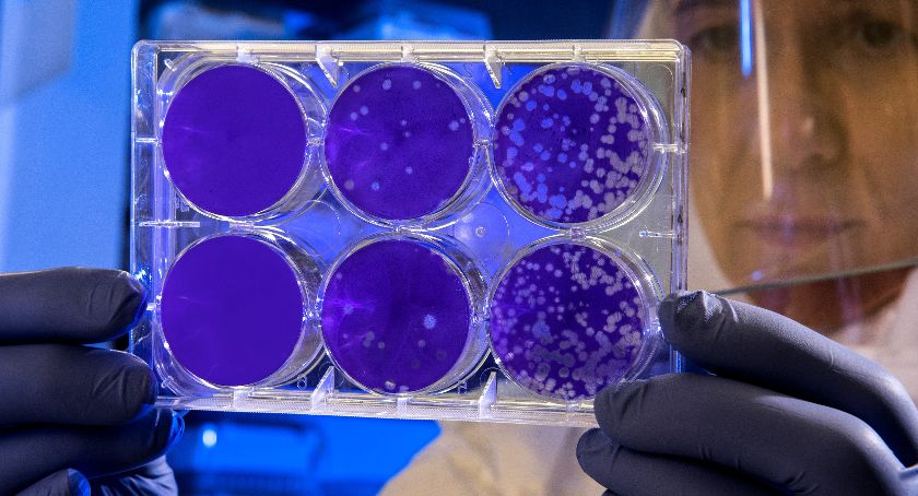 Stan epidemiologiczny na 13 lutego