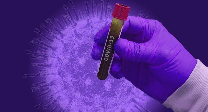 Stan epidemiologiczny na 17 lutego