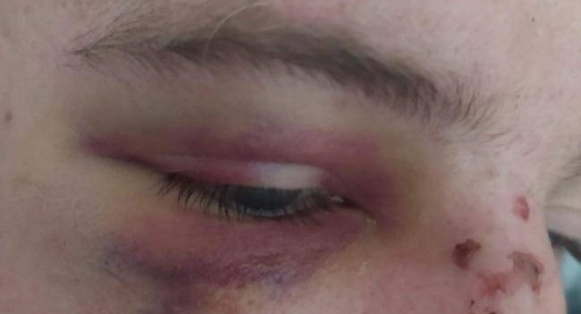 Wraca temat sprawy pobicia narzeczonego wolontariuszki, która przyjechała na kontrolę