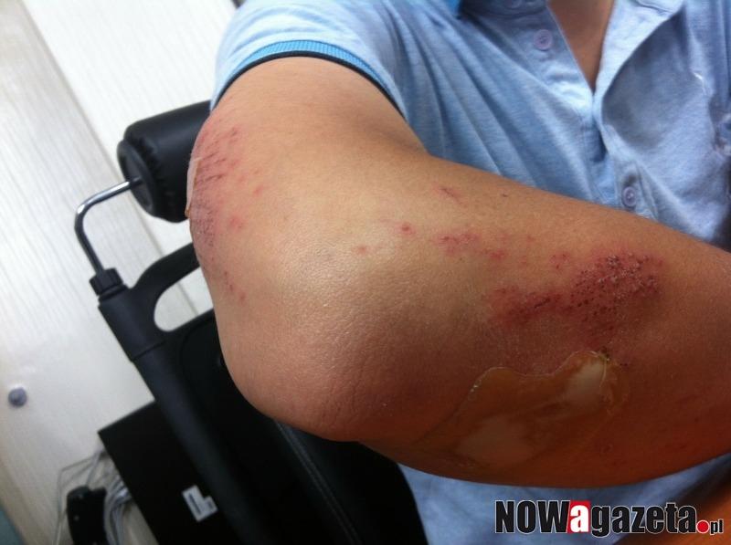 W biały dzień pobili młodego chłopaka. Policja szuka świadków