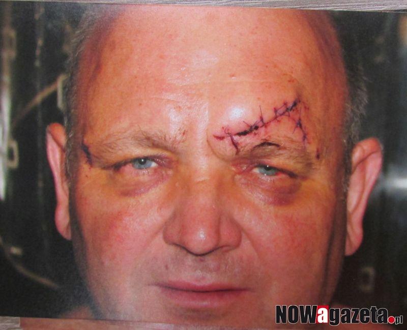 Skatowali przypadkowego mężczyznę. Zrujnowali mu życie i zdrowie...