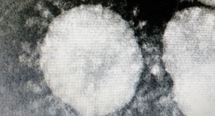 Minister Zdrowia wprowadza stan zagrożenia epidemicznego
