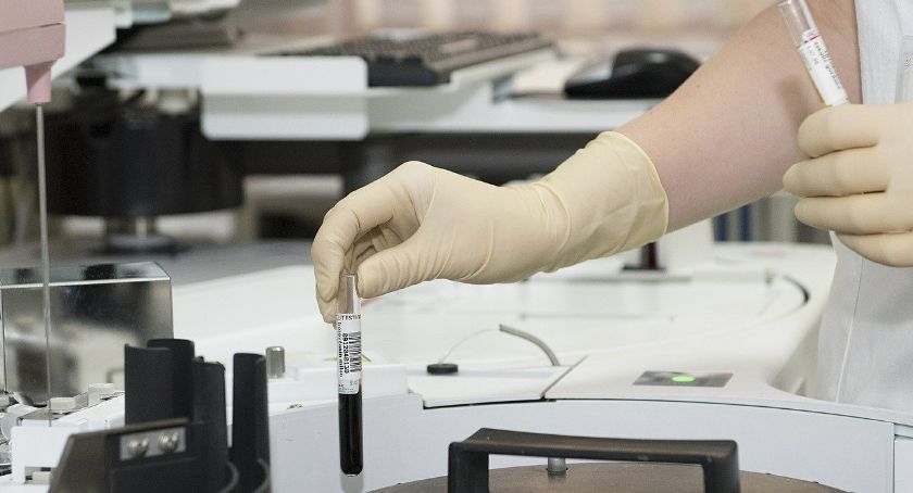 Informacje dotyczące sytuacji epidemicznej w regionie