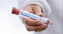 Informacje epidemiczne z regionu