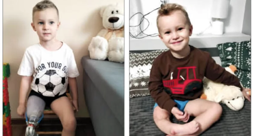 Oluś dzielnie pokonuje trudności po amputacji nóżki, możemy mu w tym pomóc
