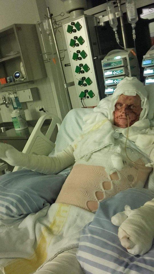 Miał tylko 10 procent szans na przeżycie! Żyje!