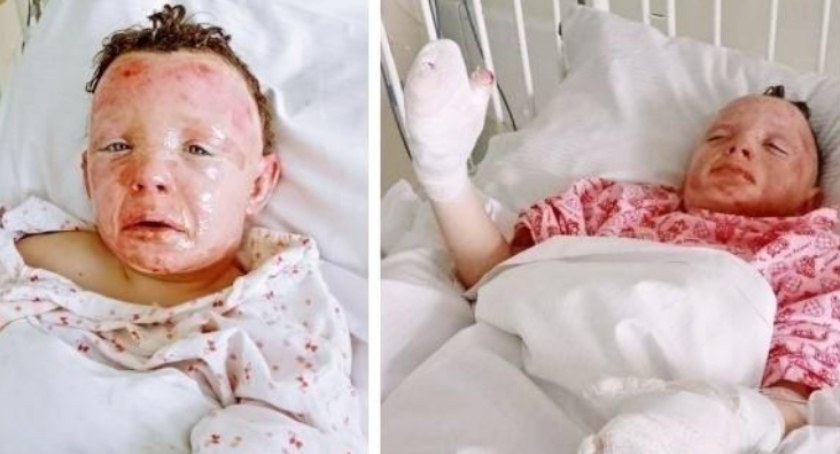 Sadek. Ich ciała poparzył potężny wybuch. Pomóżmy otrząsnąć się im po tragedii