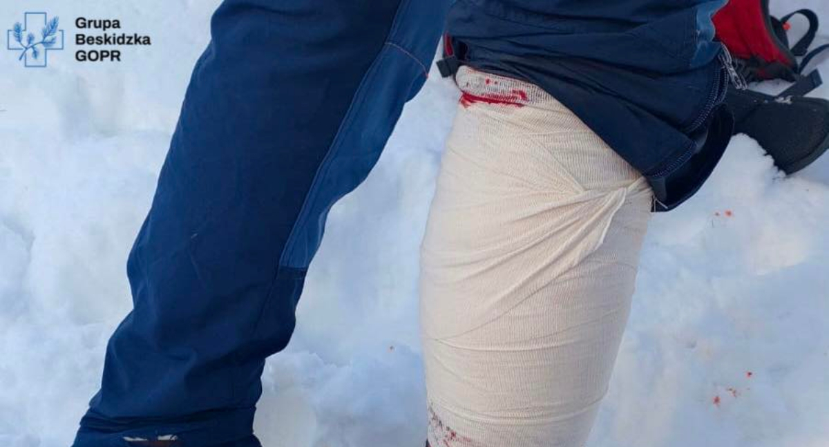Zdobywając Babią Górę poważnie zranił się rakiem! GOPR w akcji 