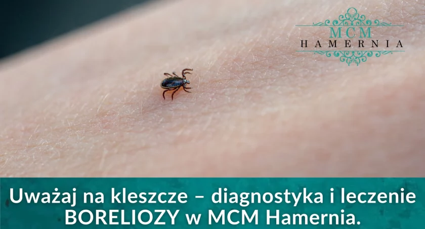 Uważaj na kleszcze! Porady specjalisty z MCM Hamernia