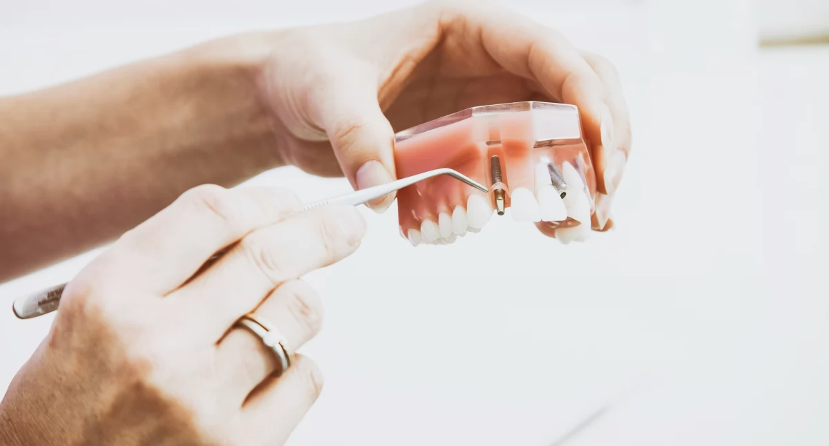 Leczenie kanałowe a interwencje chirurgiczne – kiedy potrzebna jest chirurgia stomatologiczna?