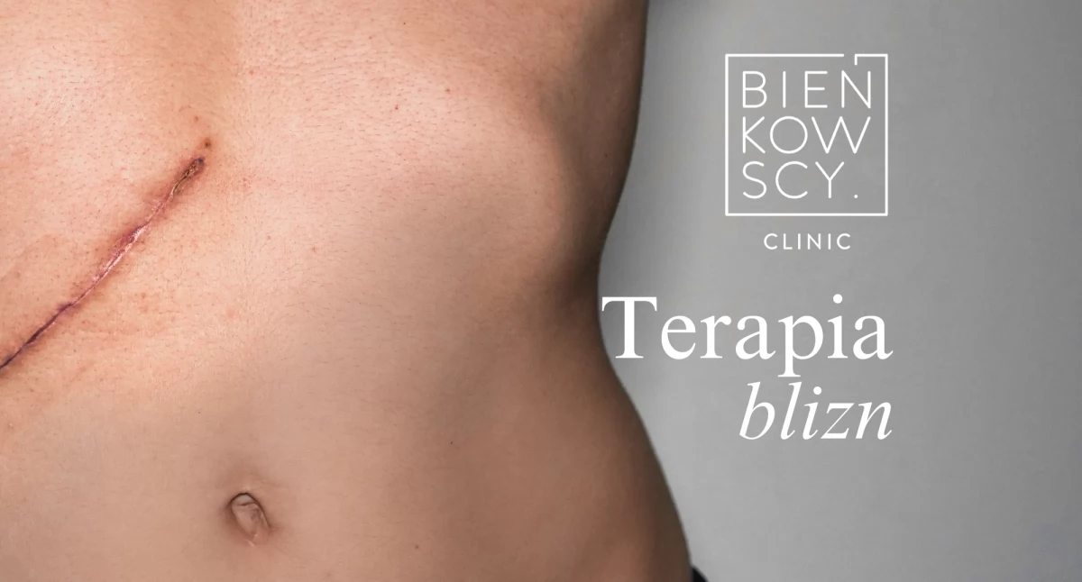 Usuwanie blizn – skuteczne metody redukcji