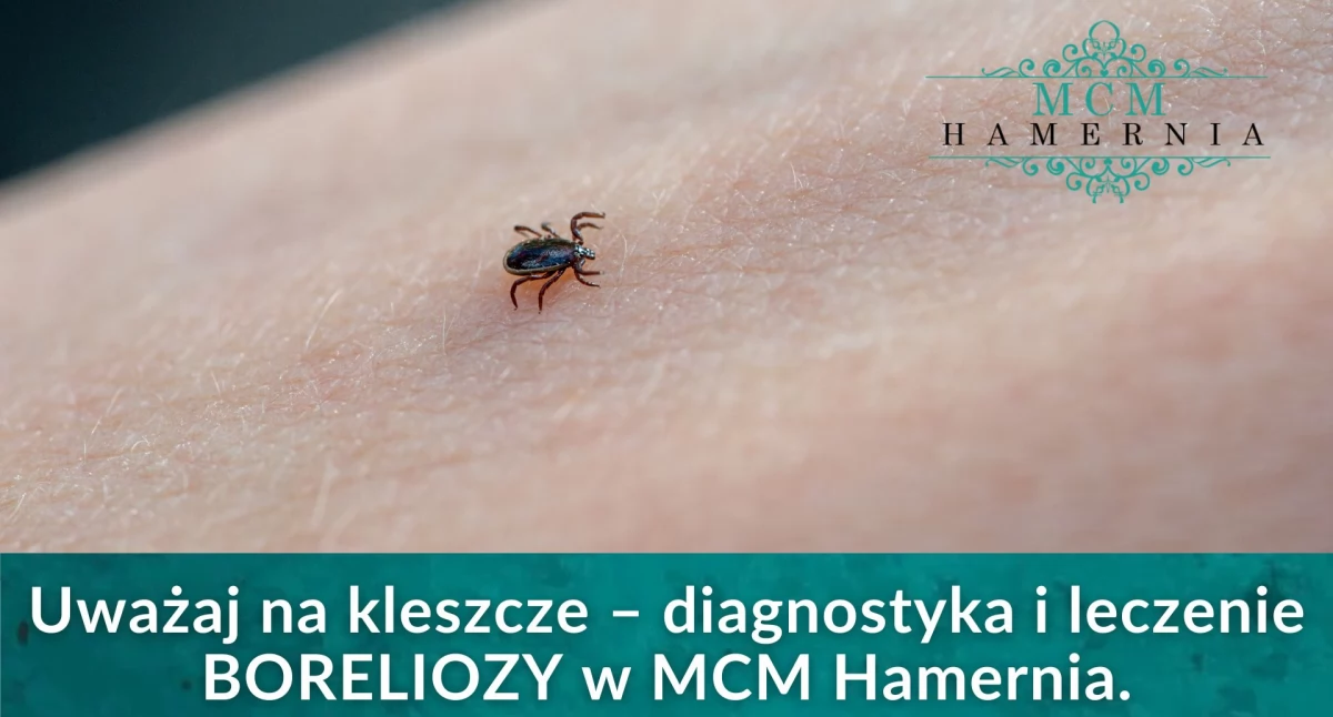 Uwaga na kleszcze! Sprawdź, jak się chronić i gdzie szukać pomocy w razie ugryzienia