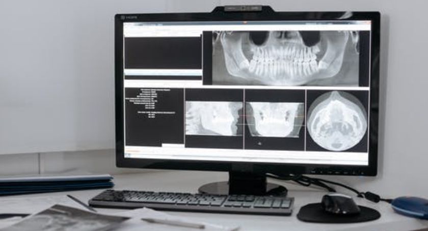 Rentgen - narzędzie podstawowej diagnostyki. Czas dowiedzieć się o nim wszystkiego