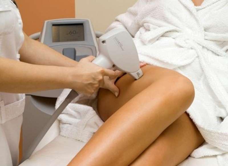 Depilacja laserowa w Magia Spa – NOWY SEZON
