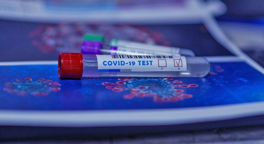 34 nauczycieli i pracowników szkół nie poddało się testom na koronawirusa