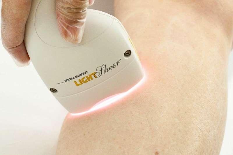DUŻA GŁOWICA do trwałej depilacji laserowej już w MAGIA SPA