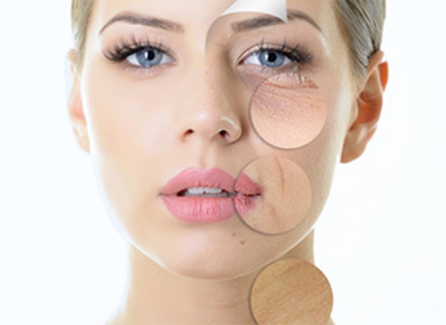 KARBOKSYTERAPIA w MAGIA SPA