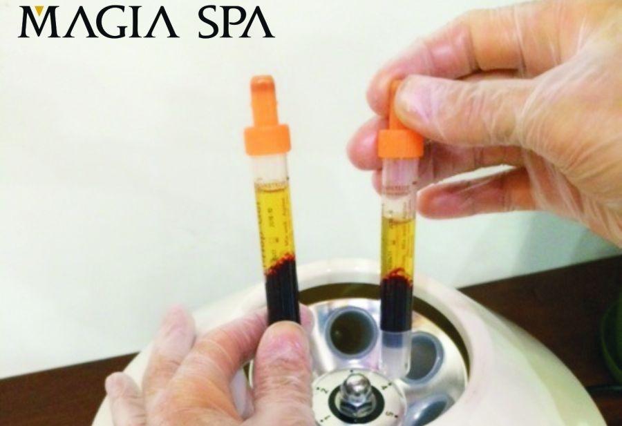 OSOCZE BOGATOPŁYTKOWE w Magia Spa