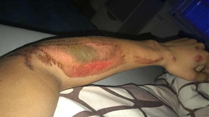 Szczęście w nieszczęściu kolarza z Zawoi