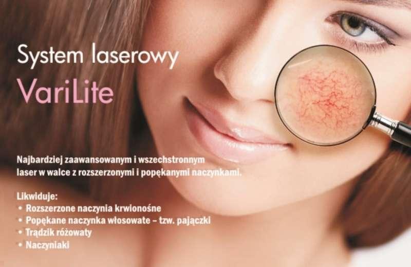 LASEROWE ZAMYKANIE NACZYNEK: HIT czy KIT?