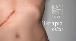 Usuwanie blizn – skuteczne metody redukcji