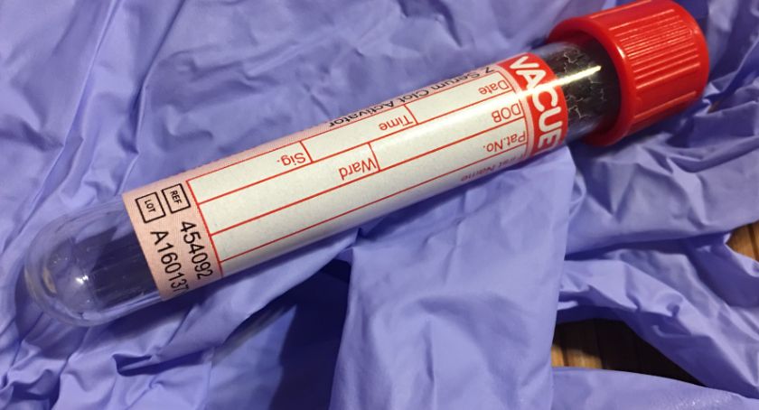 Punkt Pobrań w Ciechanowcu wznawia działalność