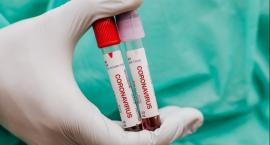Koronawirus: zmarło 49 osób, z czego 4 w Podlaskiem