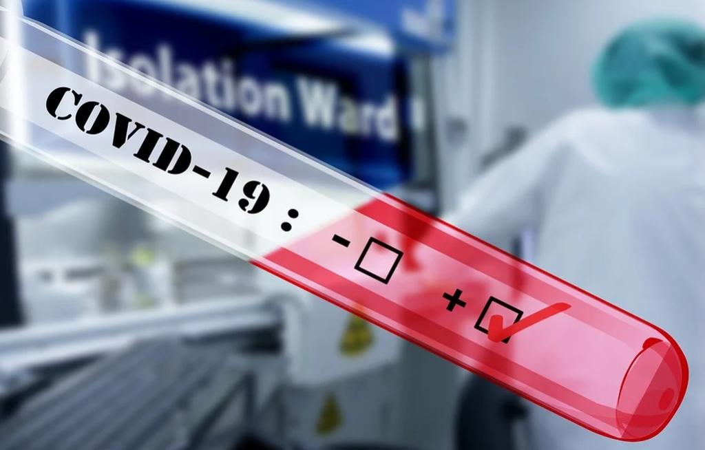 Aktualna sytuacja epidemiologiczna w Mysłowicach – 9 czerwca