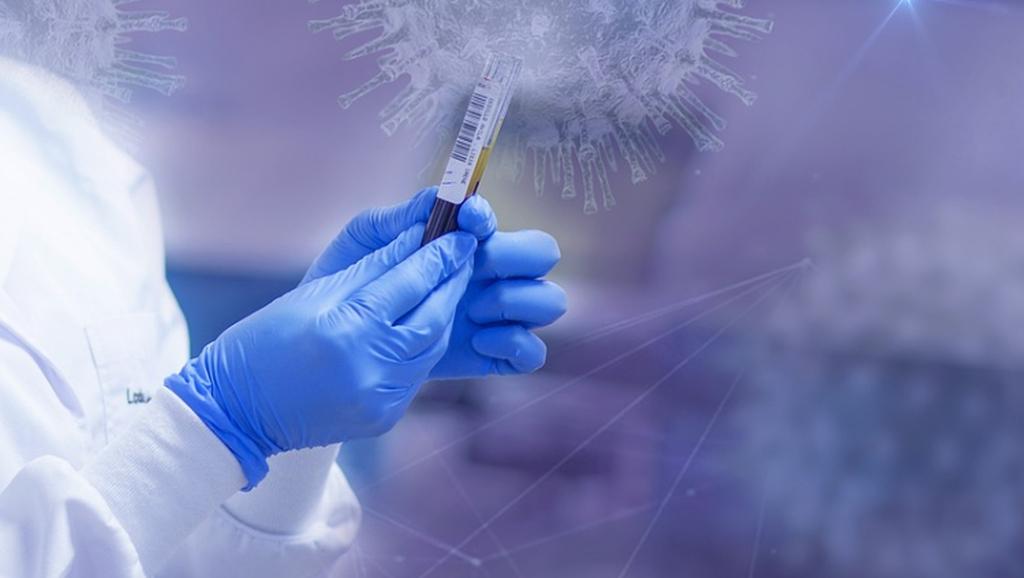 Aktualna sytuacja epidemiologiczna w Mysłowicach – 25 maja