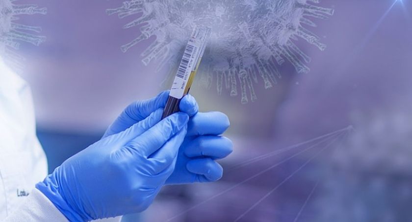 Aktualna sytuacja epidemiologiczna w Mysłowicach – 22 stycznia