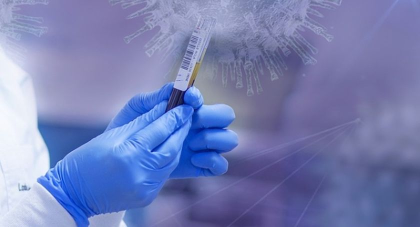 Aktualna sytuacja epidemiologiczna w Mysłowicach – 4 lutego