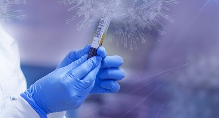 Aktualna sytuacja epidemiologiczna w Mysłowicach – 1 marca