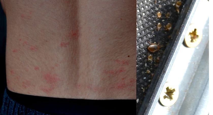 Inwazja pluskiew. Robactwo w mieszkaniu na Dąbrowskiego