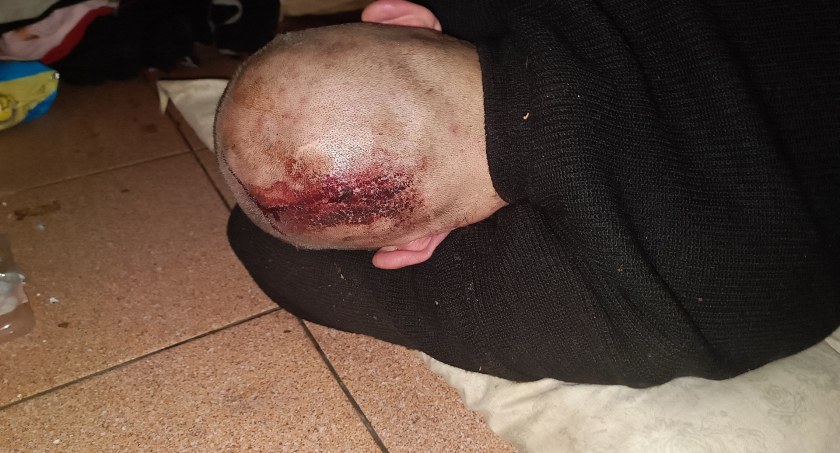 Pobicie w ogrzewalni dla bezdomnych mężczyzn
