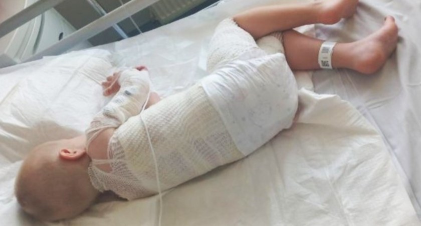 Na pomoc Kubusiowi. Poważnie poparzony mały mysłowiczanin czeka na przeszczep skóry