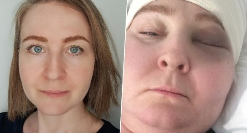 Monika zbiera pieniądze na operację. Czasu zostało niewiele 