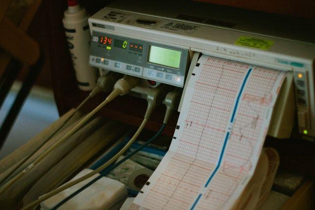 EKG i Holter EKG ? Jak wygląd ten rodzaj badań?