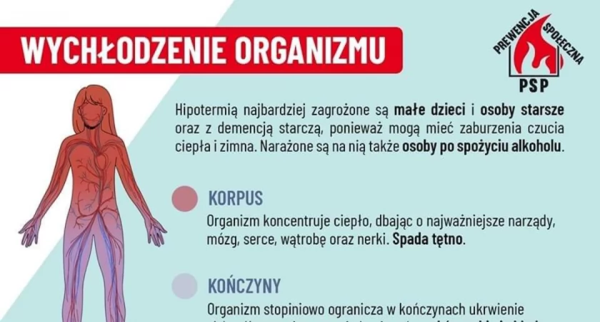 Hipotermia