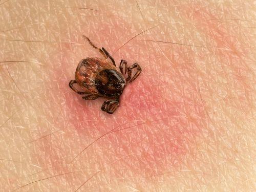 Borelioza test - dowiedz się czemu jest tak ważny dla Twojego zdrowia!