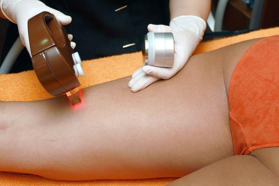 Czy depilacja laserowa jest skuteczna?