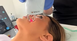 Laser Tulowy 1928 nm KATHARSIS Salon Zdrowia i Urody