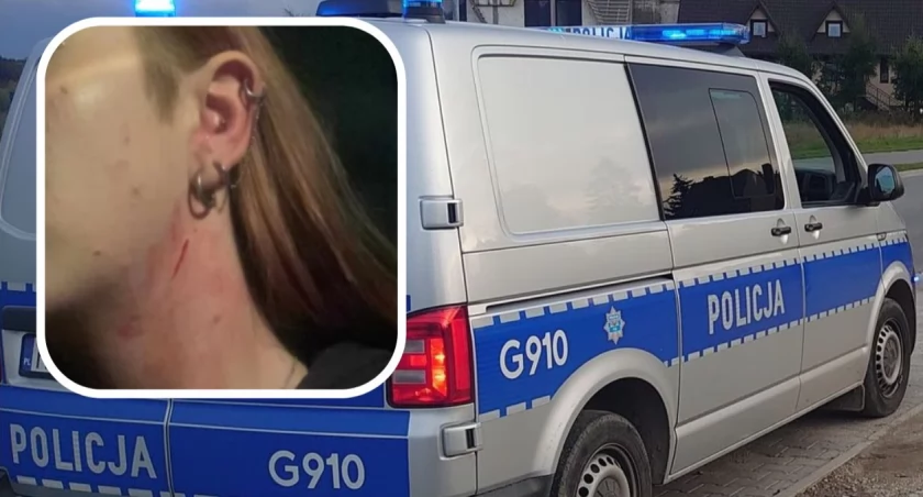 Nowotarscy policjanci zatrzymali mężczyznę, który napadł kobietę 