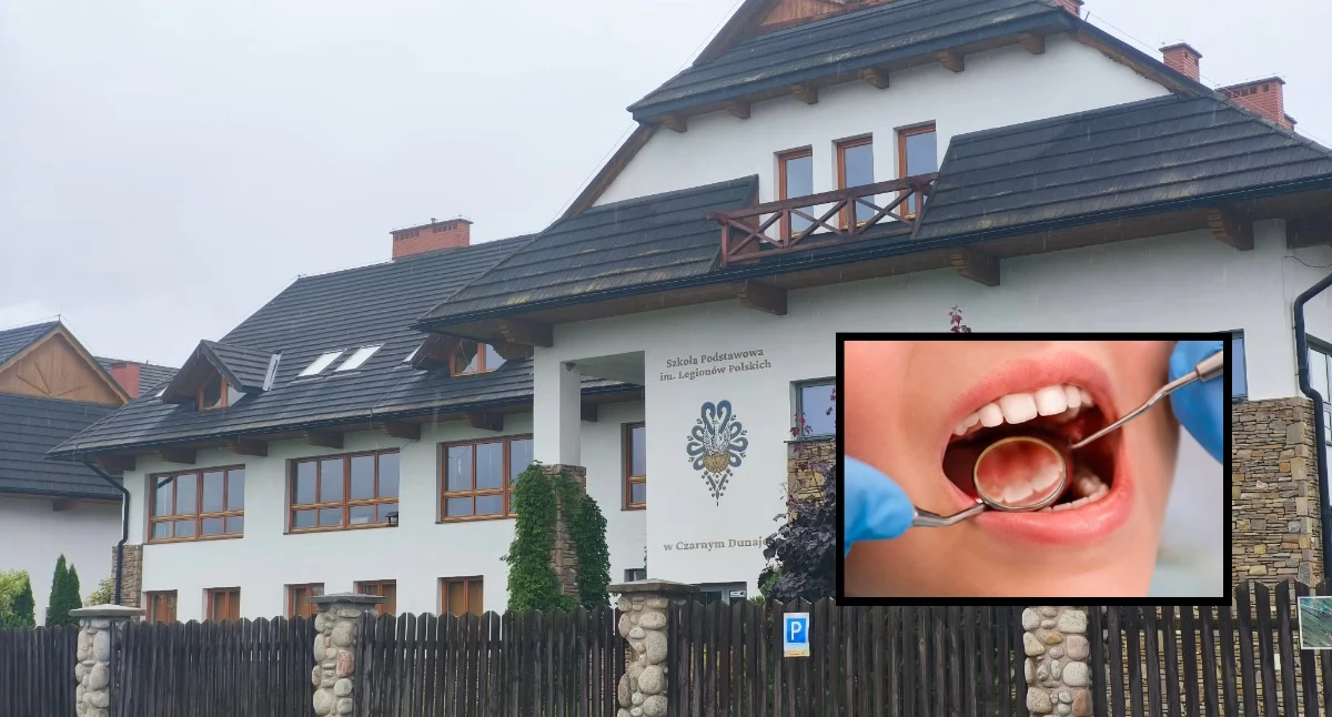 Akademia Uśmiechu w Czarnym Dunajcu - bezpłatna opieka stomatologiczna dla najmłodszych