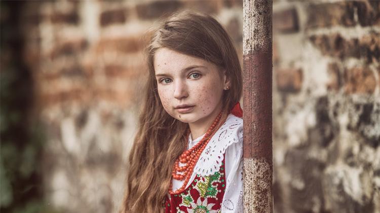 Pomóżmy Zuzi odkupić leki spalone w pożarze
