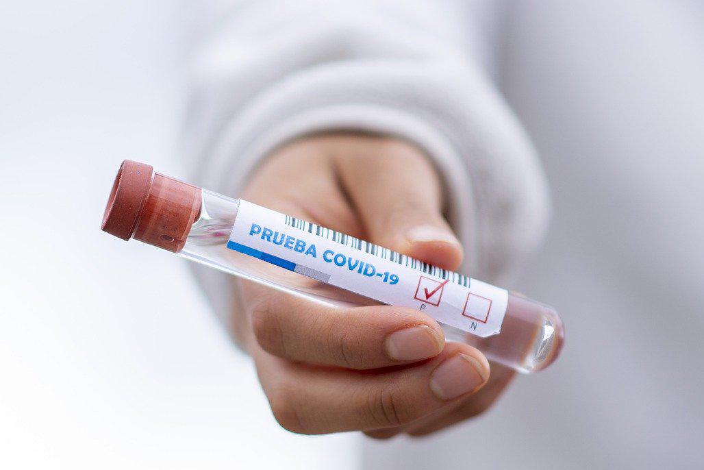 500 tysięcy szybkich testów diagnozujących koronawirusa trafi na SOR-y i izby przyjęć